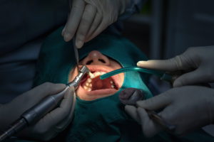 closeup dentist and assistant operating for checki 7L5B6TJ 1