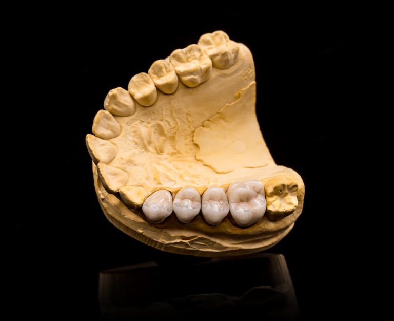 artificial-teeth-PT5UFWX (1)