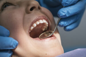 close up of dentist during a dental intervention w 2023 11 27 05 20 40 utc