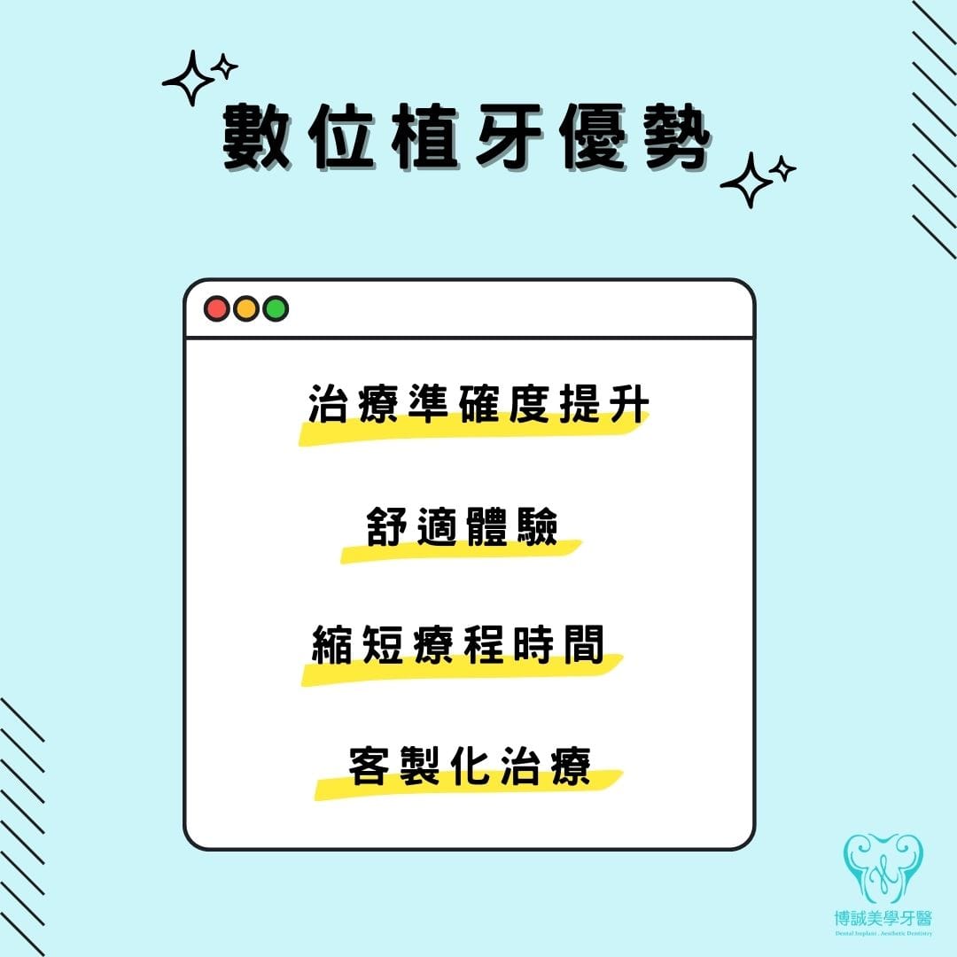 數位植牙優勢