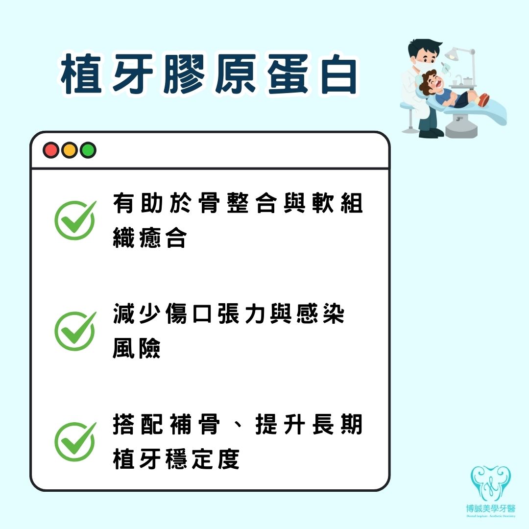 植牙膠原蛋白是什麼?手術過程中為何需要它? 1 植牙膠原蛋白