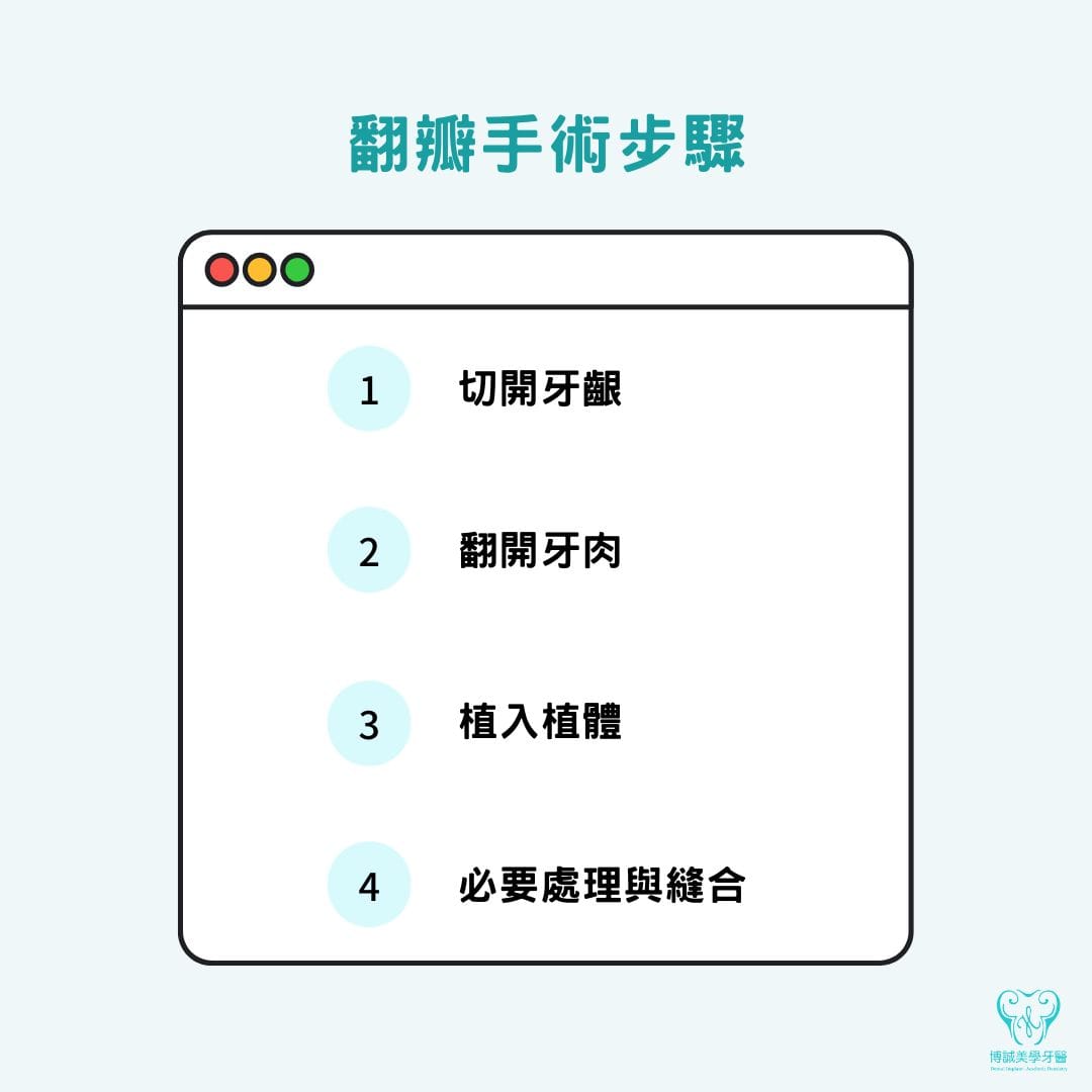 植牙翻瓣手術是什麼?過程、恢復期與照護全攻略 1 翻瓣手術步驟