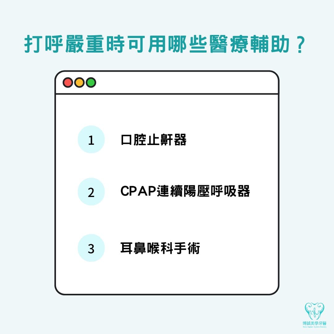 打呼嚴重時可用口腔止鼾器、CPAP連續陽壓呼吸器與耳鼻喉科治療等醫療輔助改善
