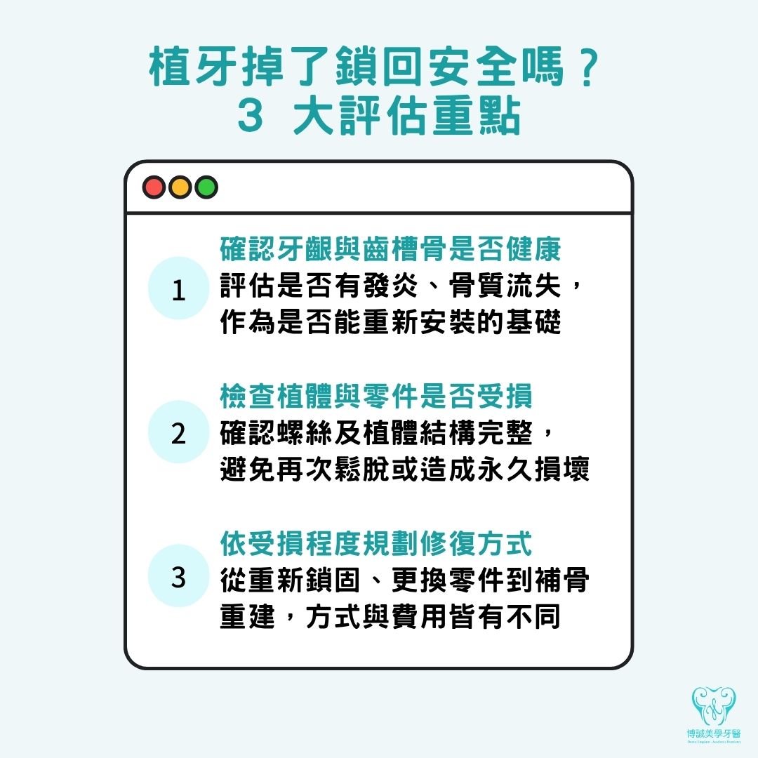 植牙掉了怎麼辦?急救 3 步驟與掉落原因全解析 3 植牙掉了鎖回安全嗎?3 大評估重點