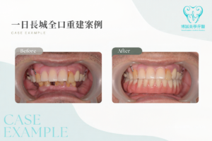 0924case01