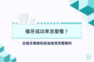 首頁 4 植牙成功率怎麼看?從植牙風險到術後搖晃完整解析
