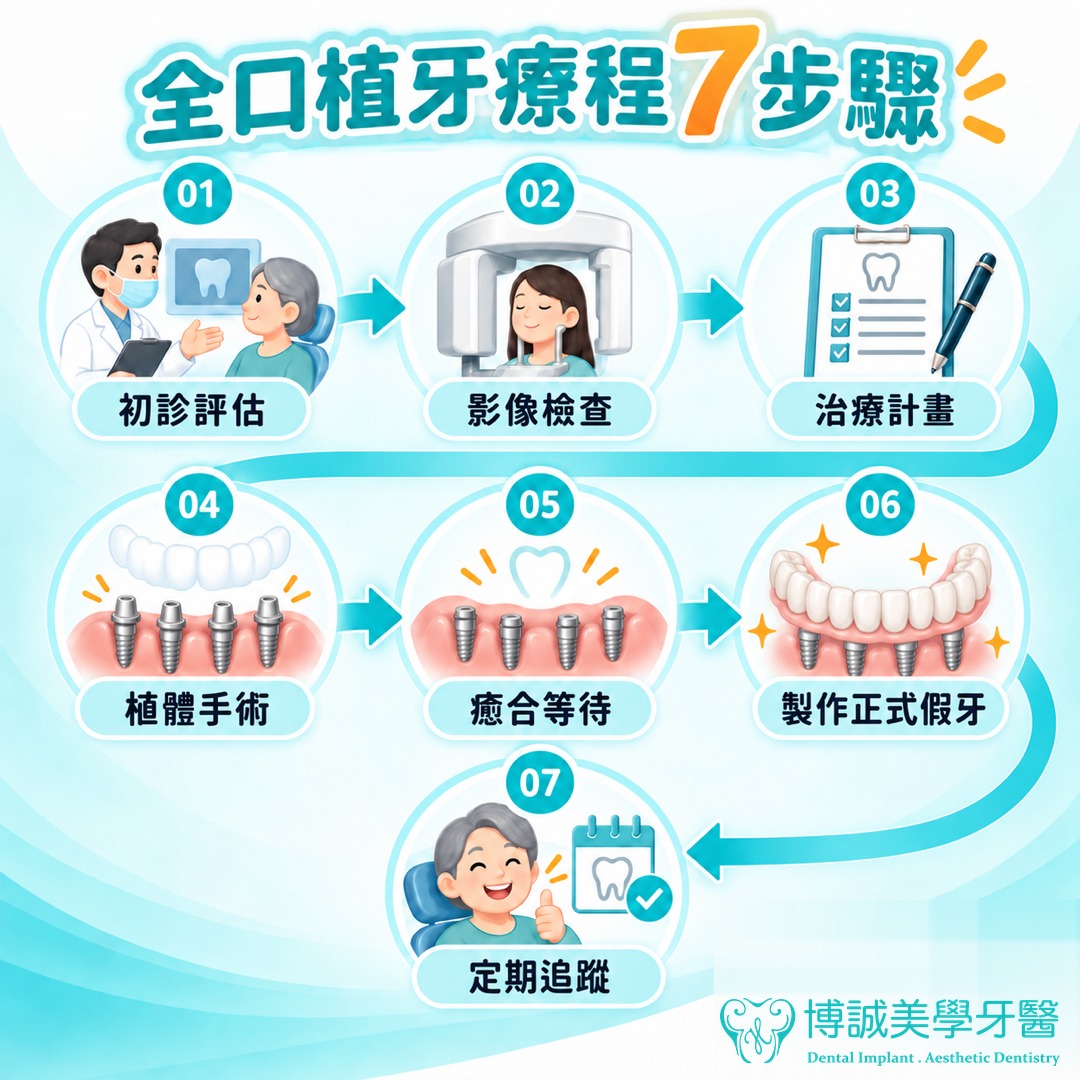 全口植牙療程 7 步驟圖解：初診評估、影像檢查、治療計畫、植體手術、癒合等待、製作正式假牙、定期追蹤