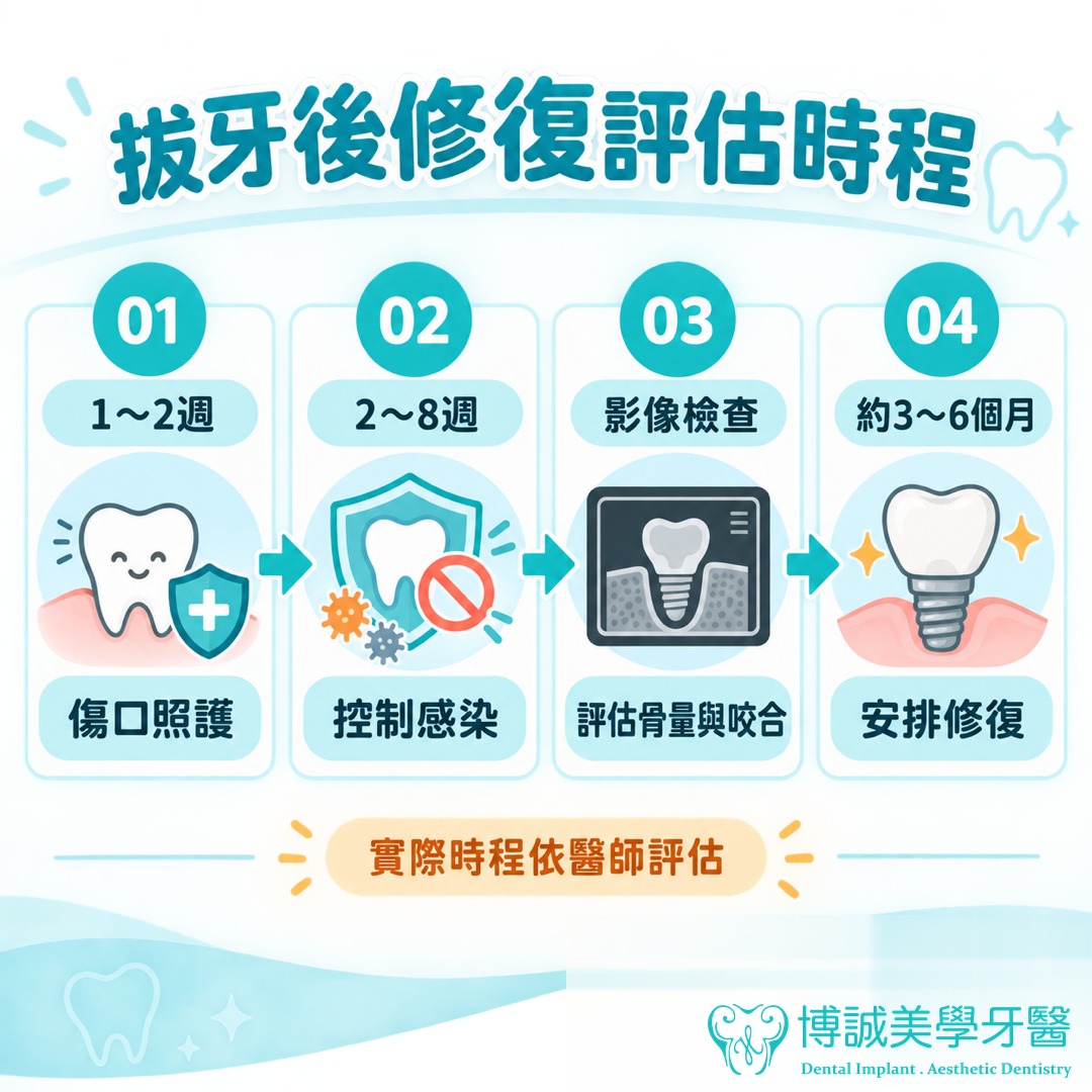 拔牙後修復評估時程圖解：1～2 週傷口照護、2～8 週控制感染、影像檢查評估骨量與咬合、約 3～6 個月安排修復，實際時程依醫師評估